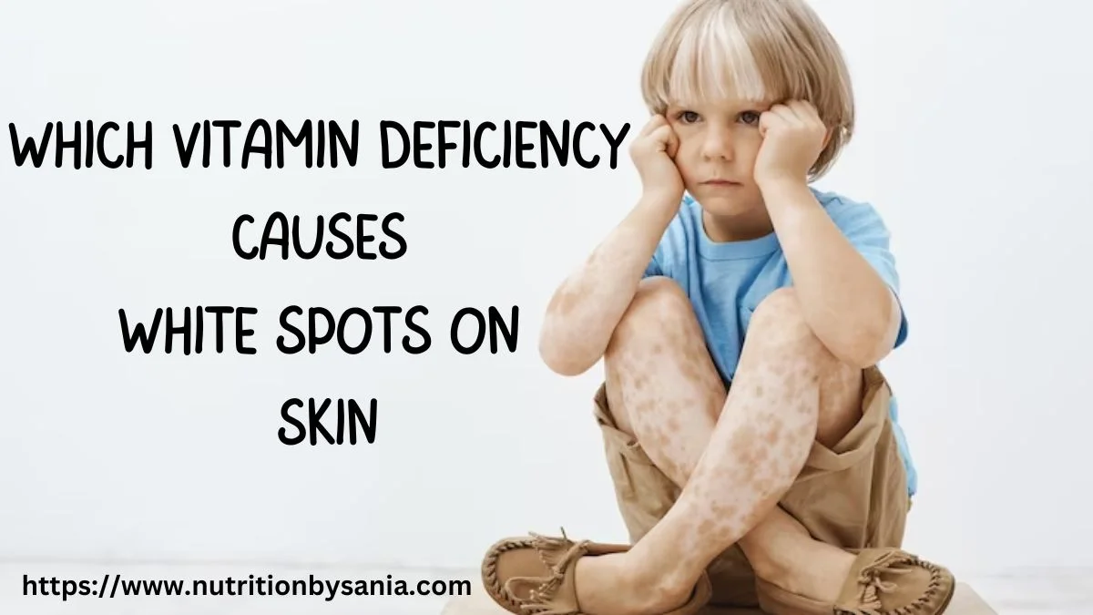 what-vitamin-deficiency-small-white-spots-on-skin-nutrition-by-sania